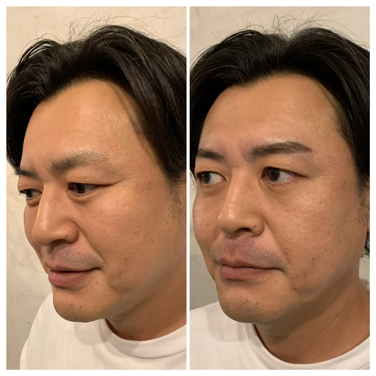 アイブロウスタイリング ビフォーアフター