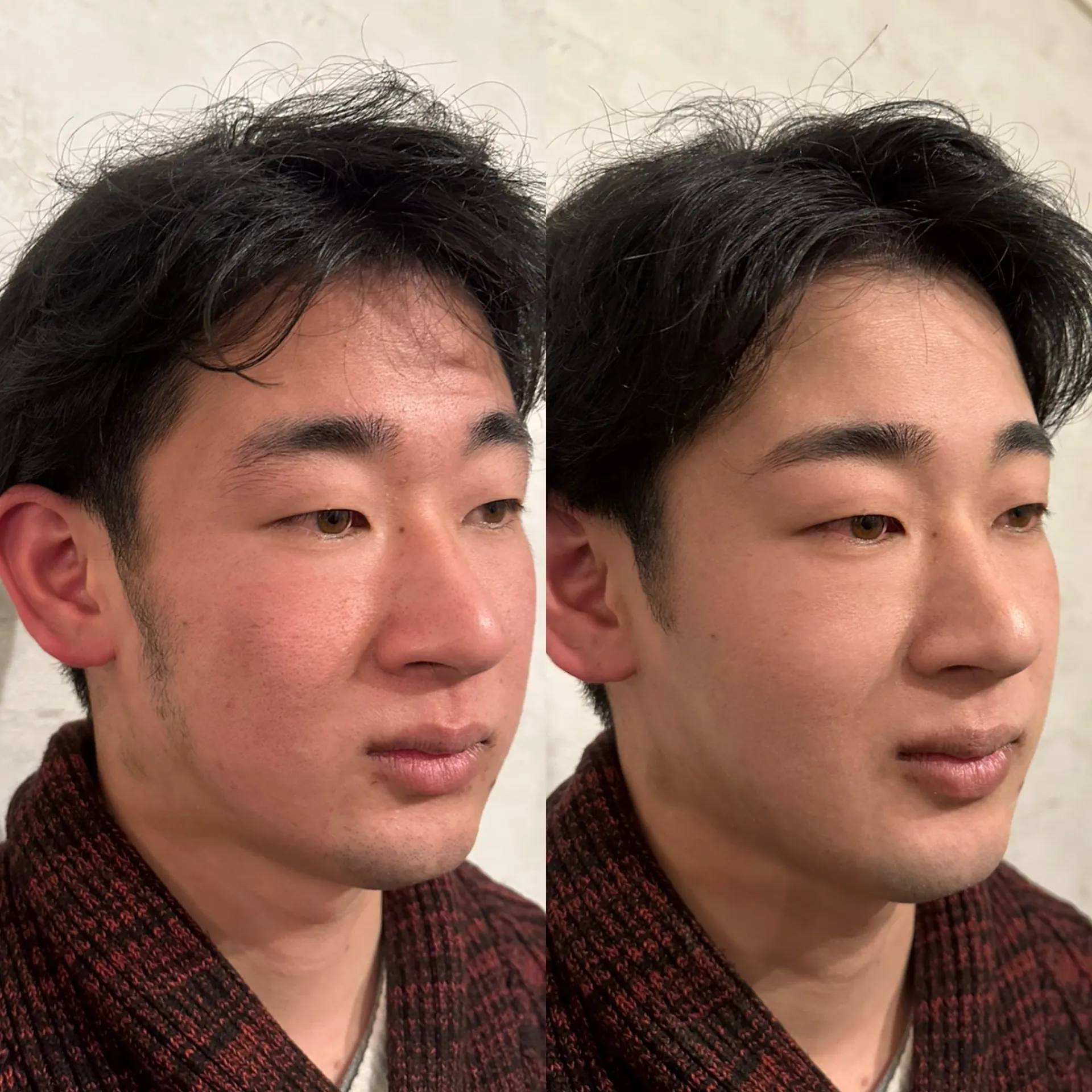 髭全体&眉スタイリング脱毛&身だしなみメンズメイク ビフォーアフター